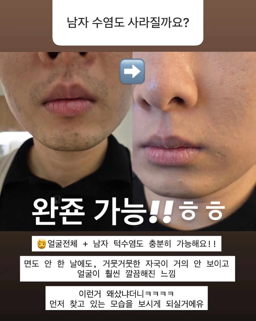 신발 방수 커버 8