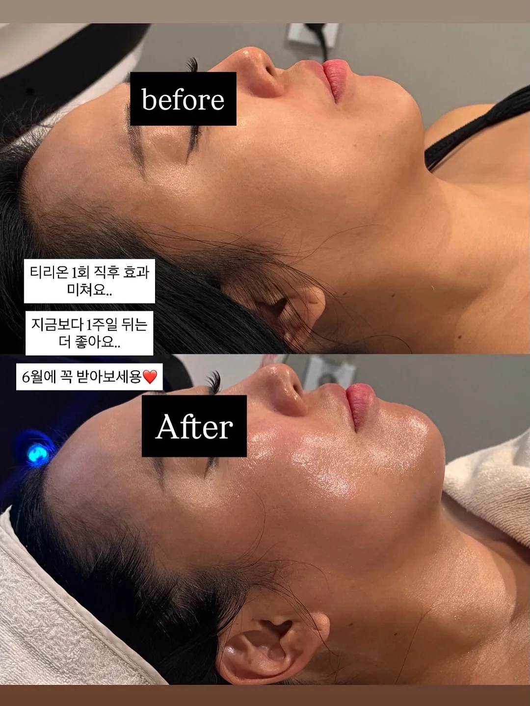 아이피키 마이베베 프로바이오틱스 2