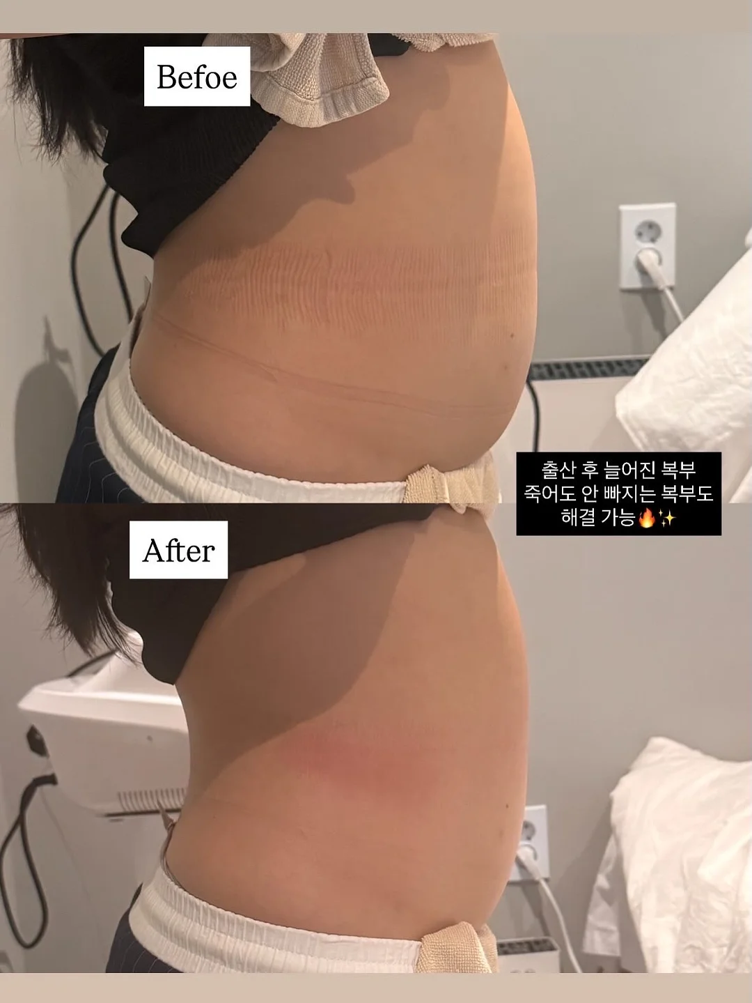 아이피키 마이베베 프로바이오틱스 5