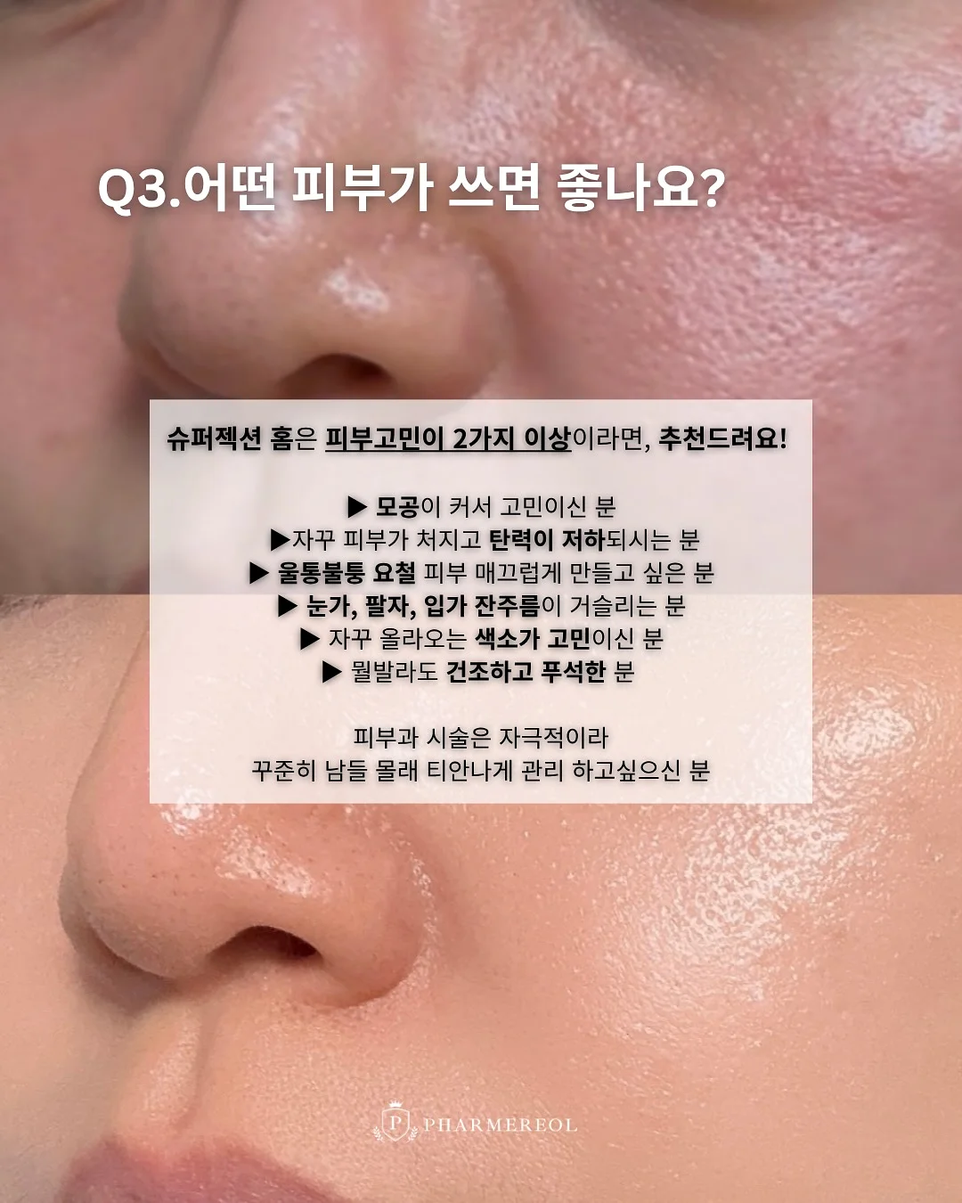 자동 팝업 텐트 4