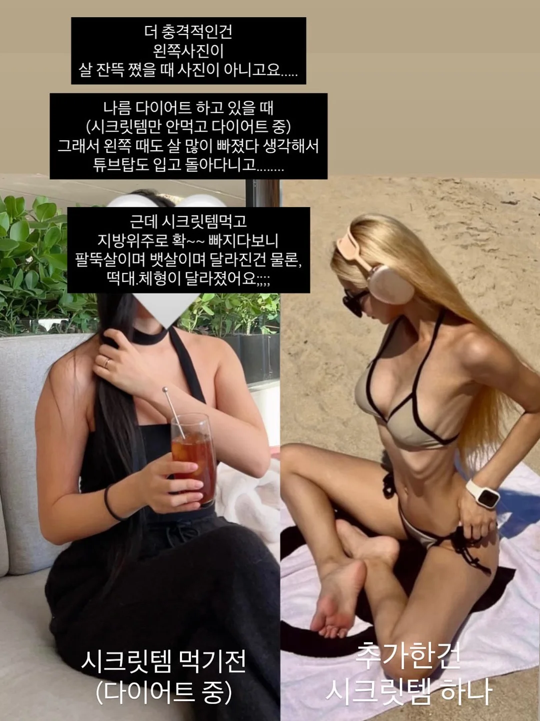 유라이크 IPL 제모기 3