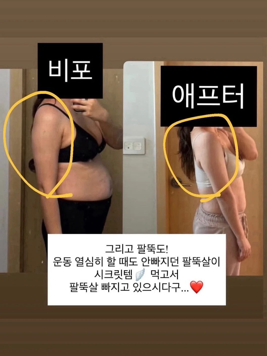 유라이크 IPL 제모기 4