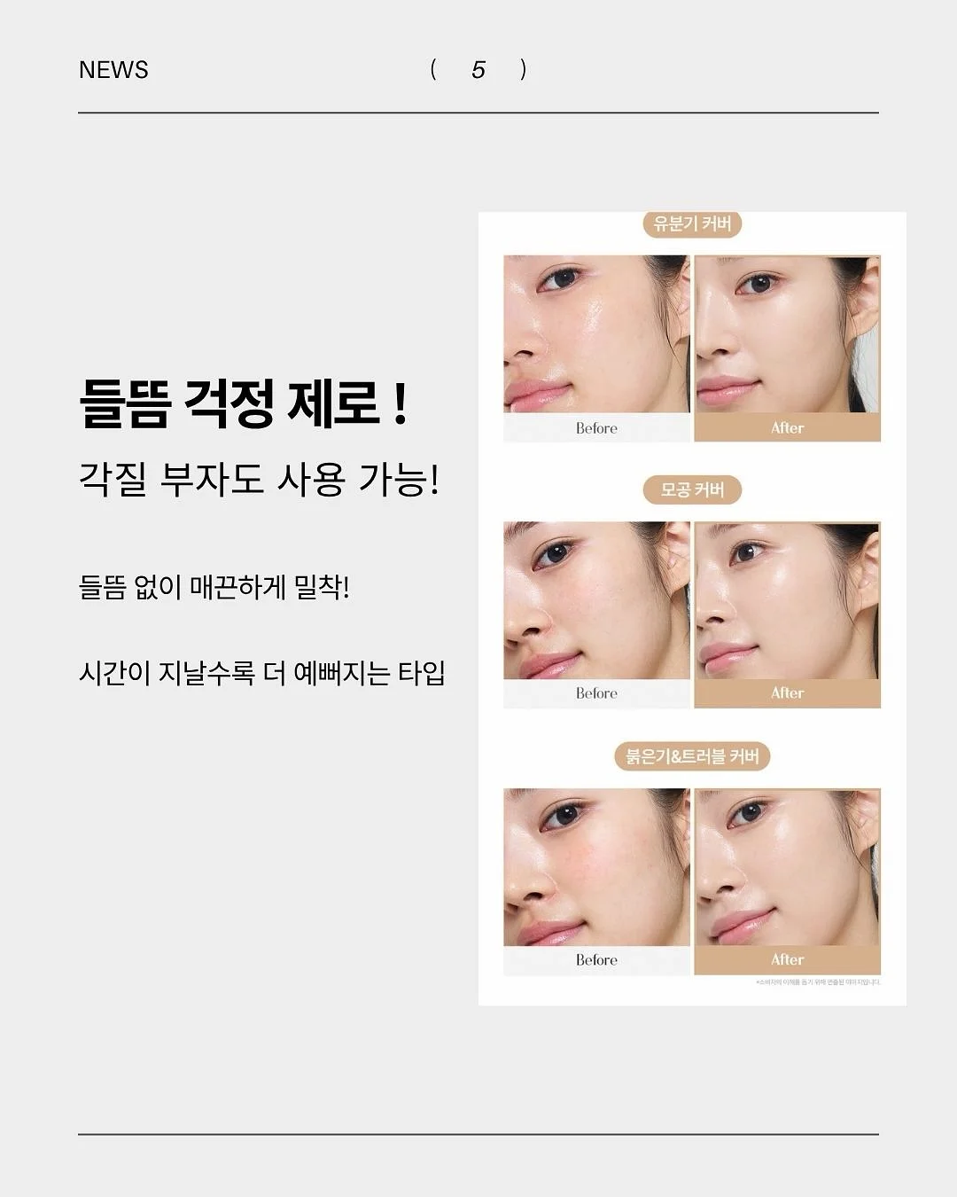 서머 리브 플레어 투피스스커트SET 5