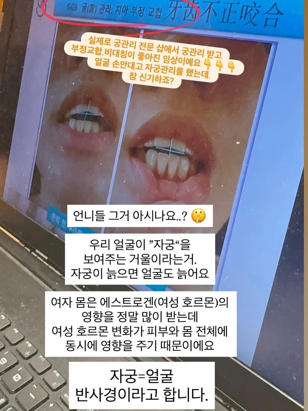 이유식 야채 소분 1