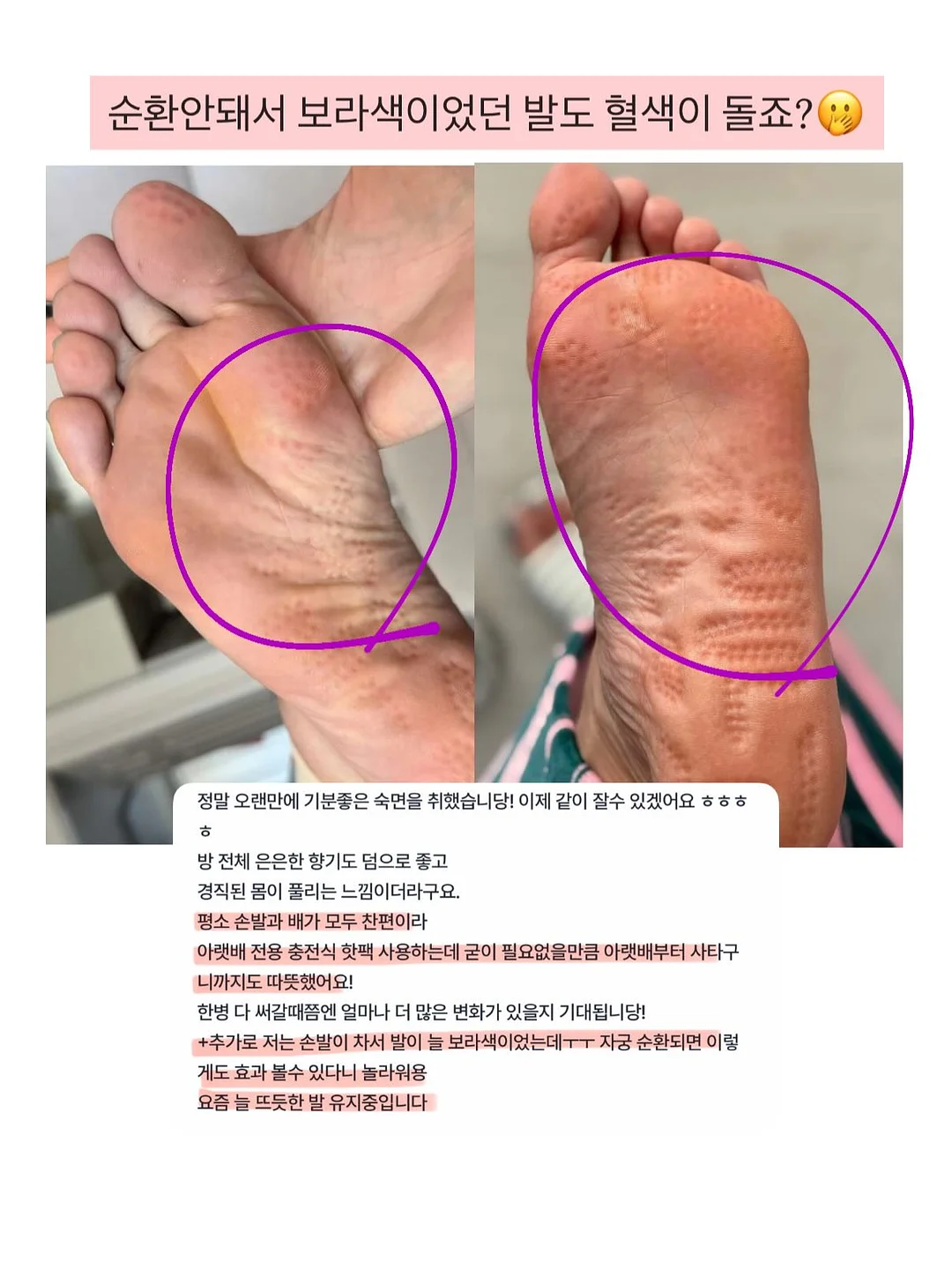 이유식 야채 소분 3