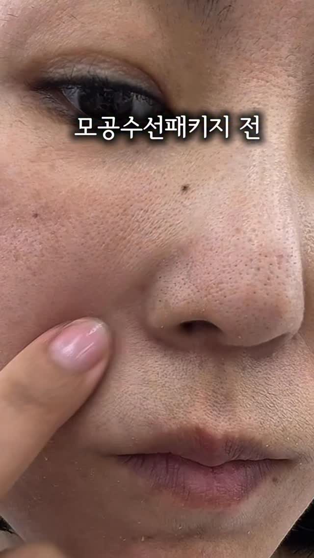 티셔츠