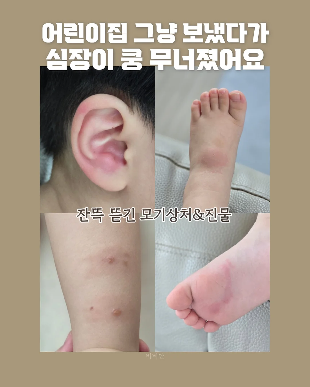 50일 아기 기념일 촬영 소품 대여 2