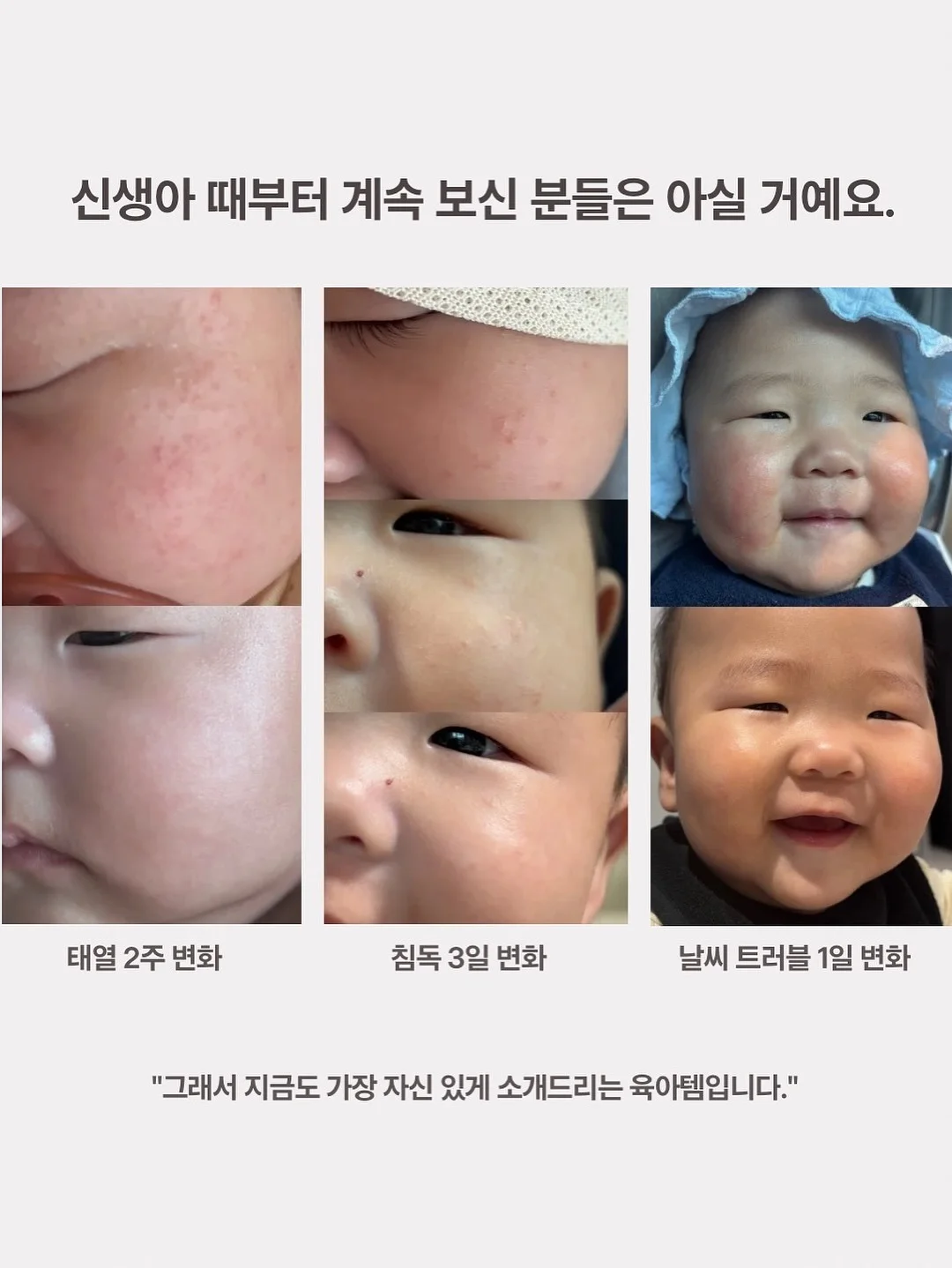 바구니백 6
