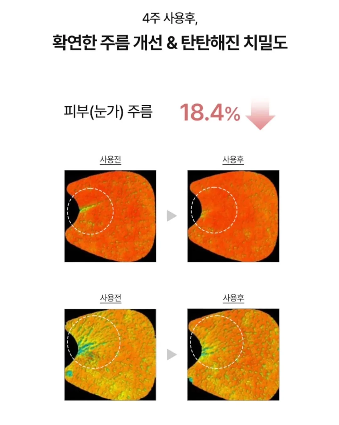 스니커즈 트윅스 아이스 바 3
