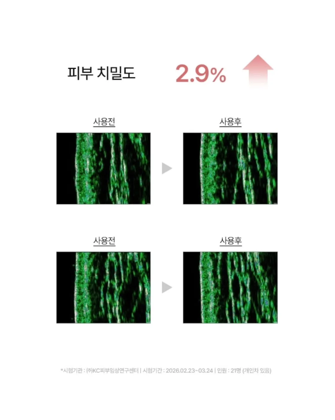 스니커즈 트윅스 아이스 바 4