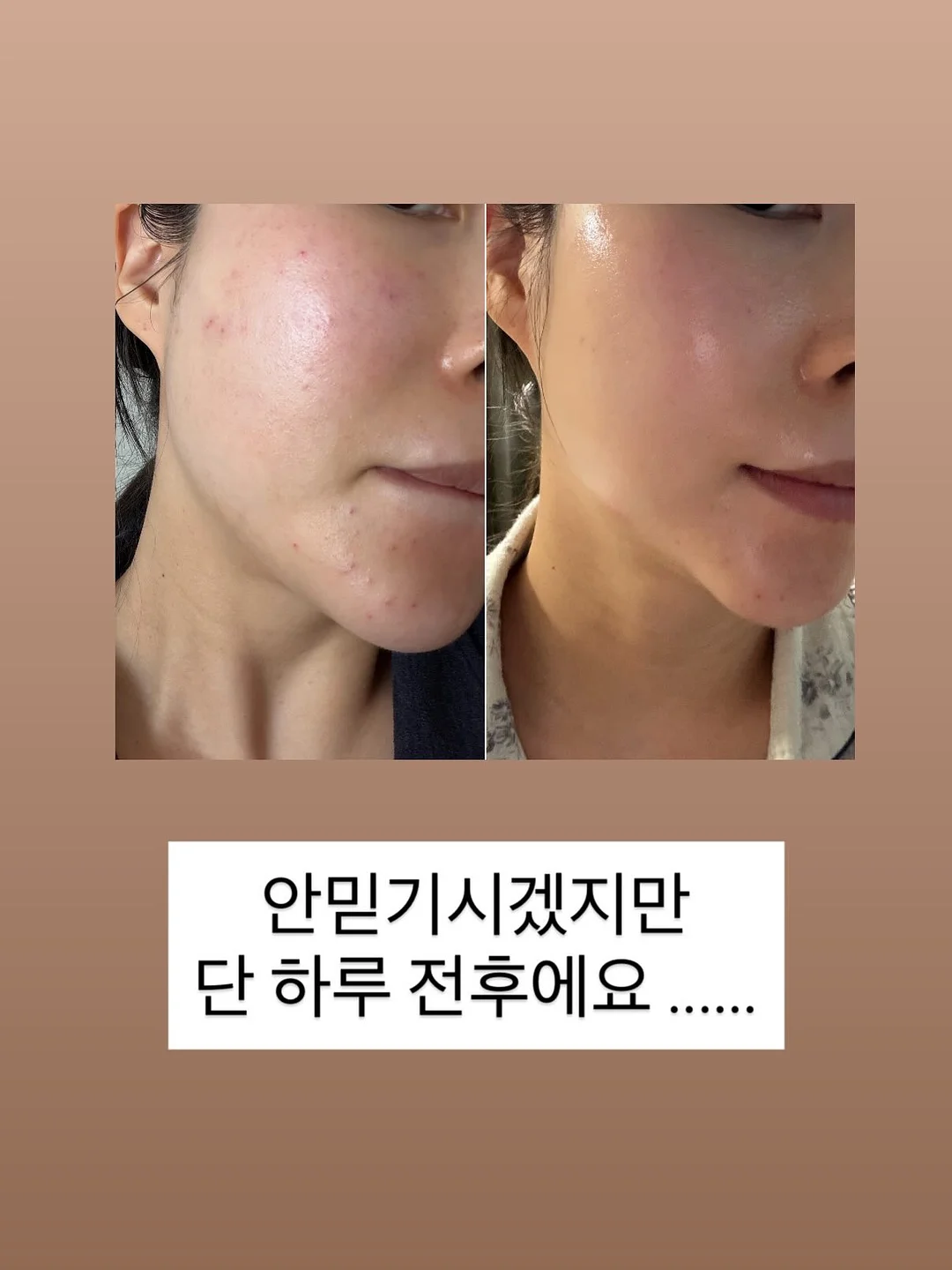뉴뜨레 딸기바나나 1