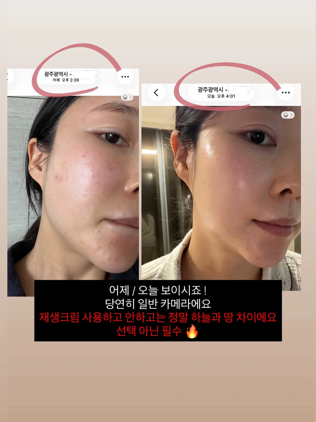 뉴뜨레 딸기바나나 2