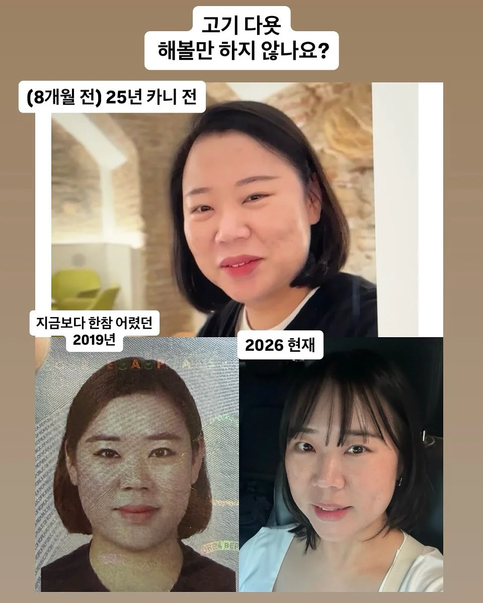 사파이어 쿨링 팬시 IPL 제모 의료기기 11