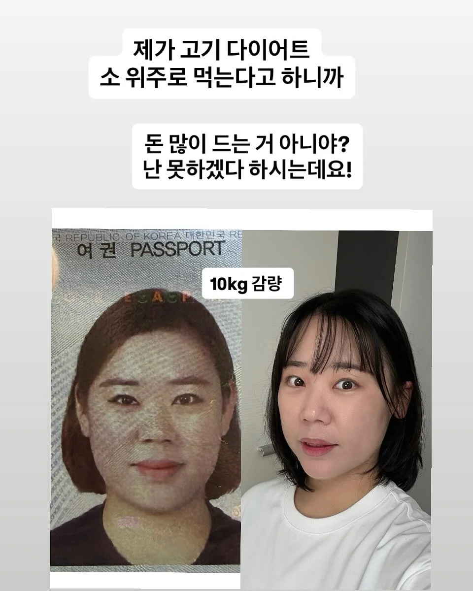 사파이어 쿨링 팬시 IPL 제모 의료기기 2