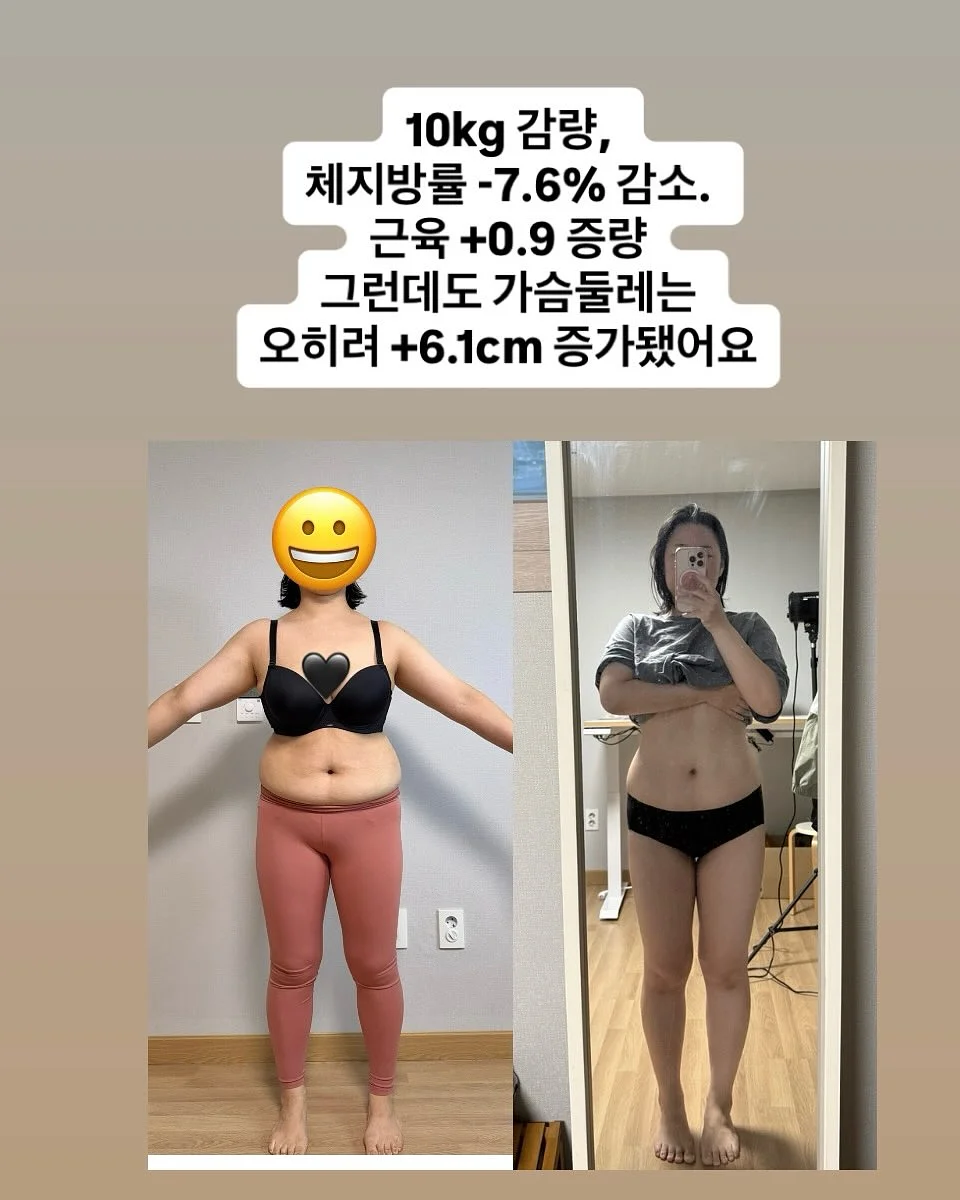 사파이어 쿨링 팬시 IPL 제모 의료기기 6