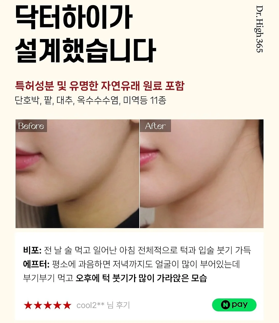 모기퇴치참 13