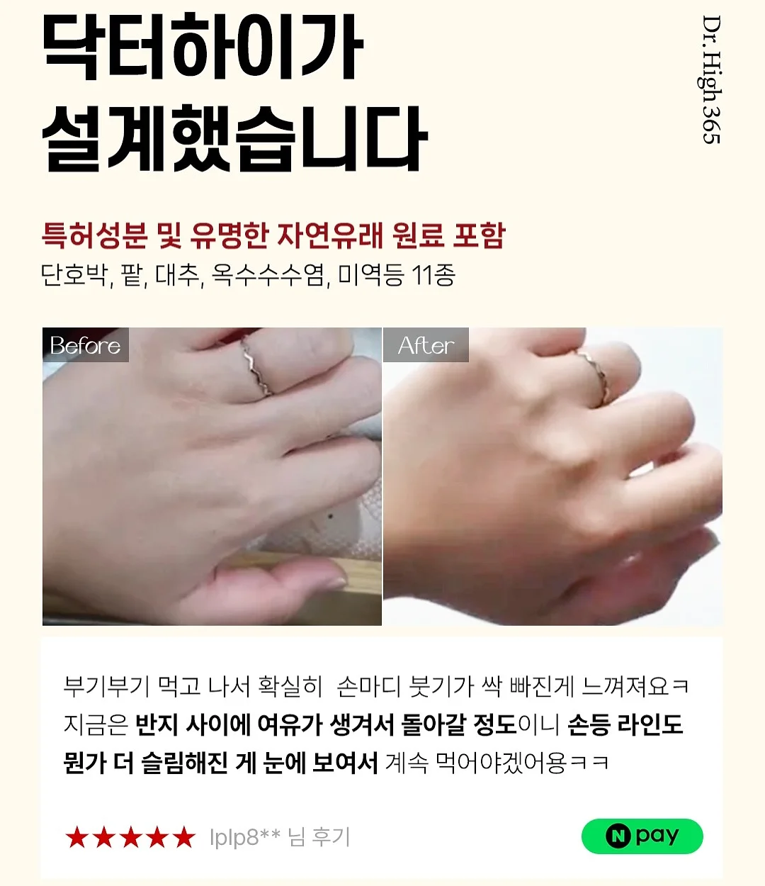 모기퇴치참 14