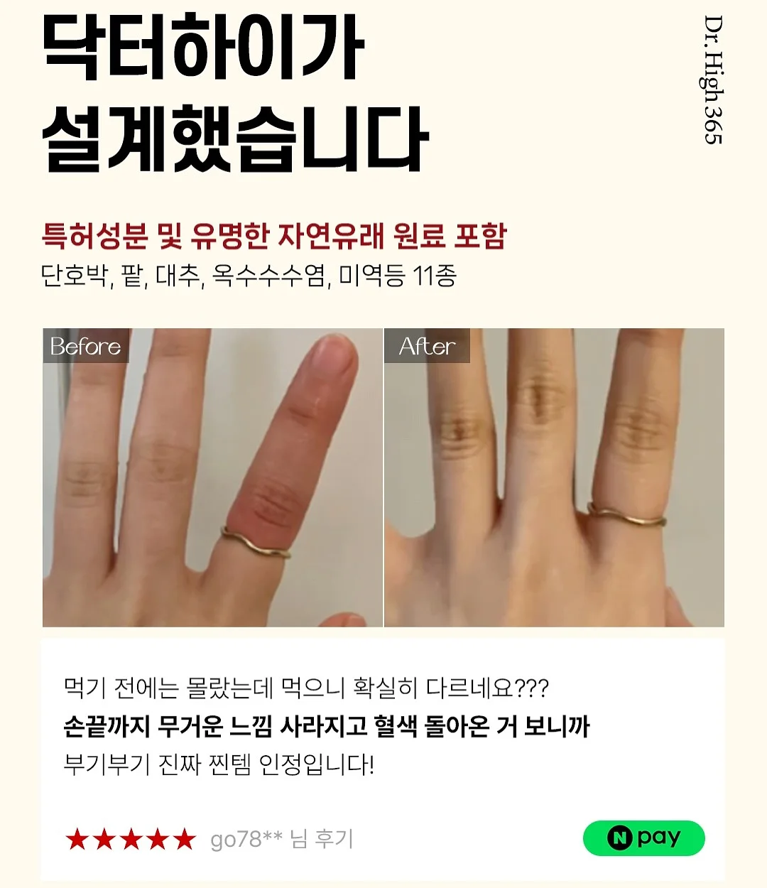 모기퇴치참 5