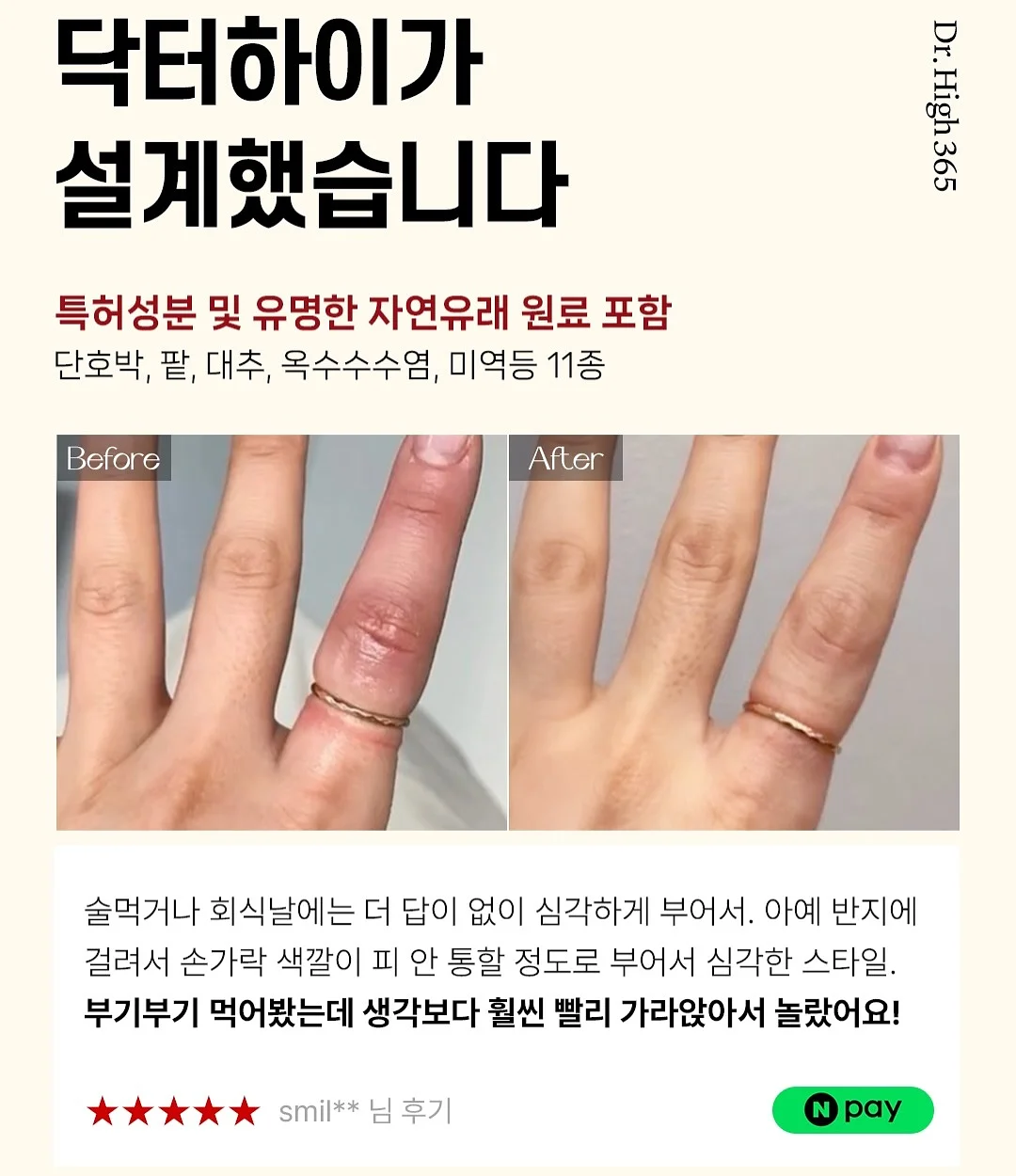 모기퇴치참 6