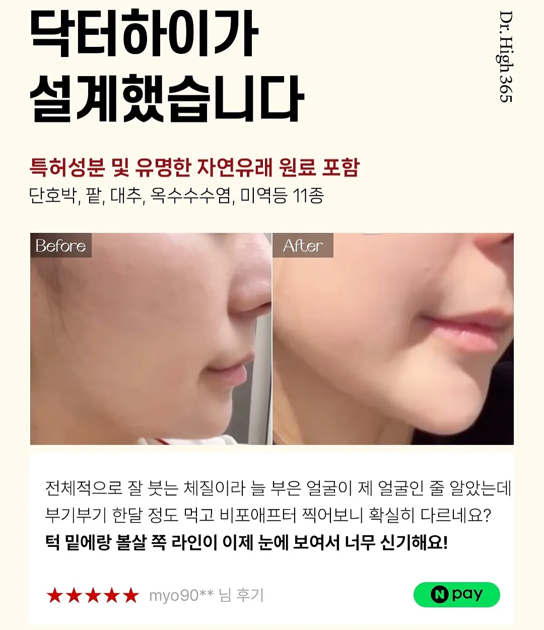 모기퇴치참 8