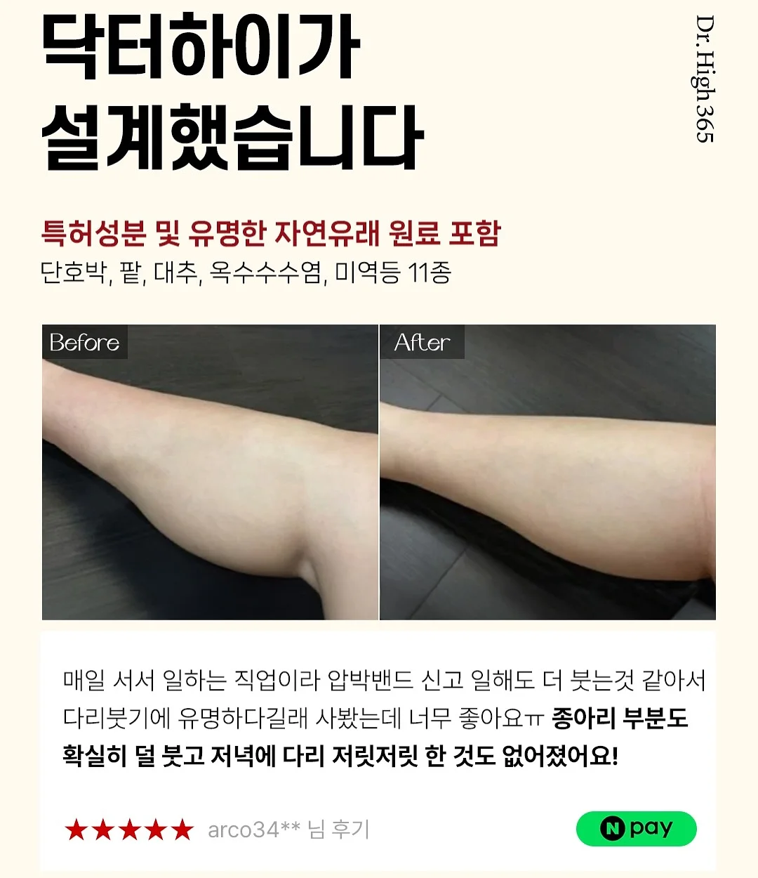 모기퇴치참 9