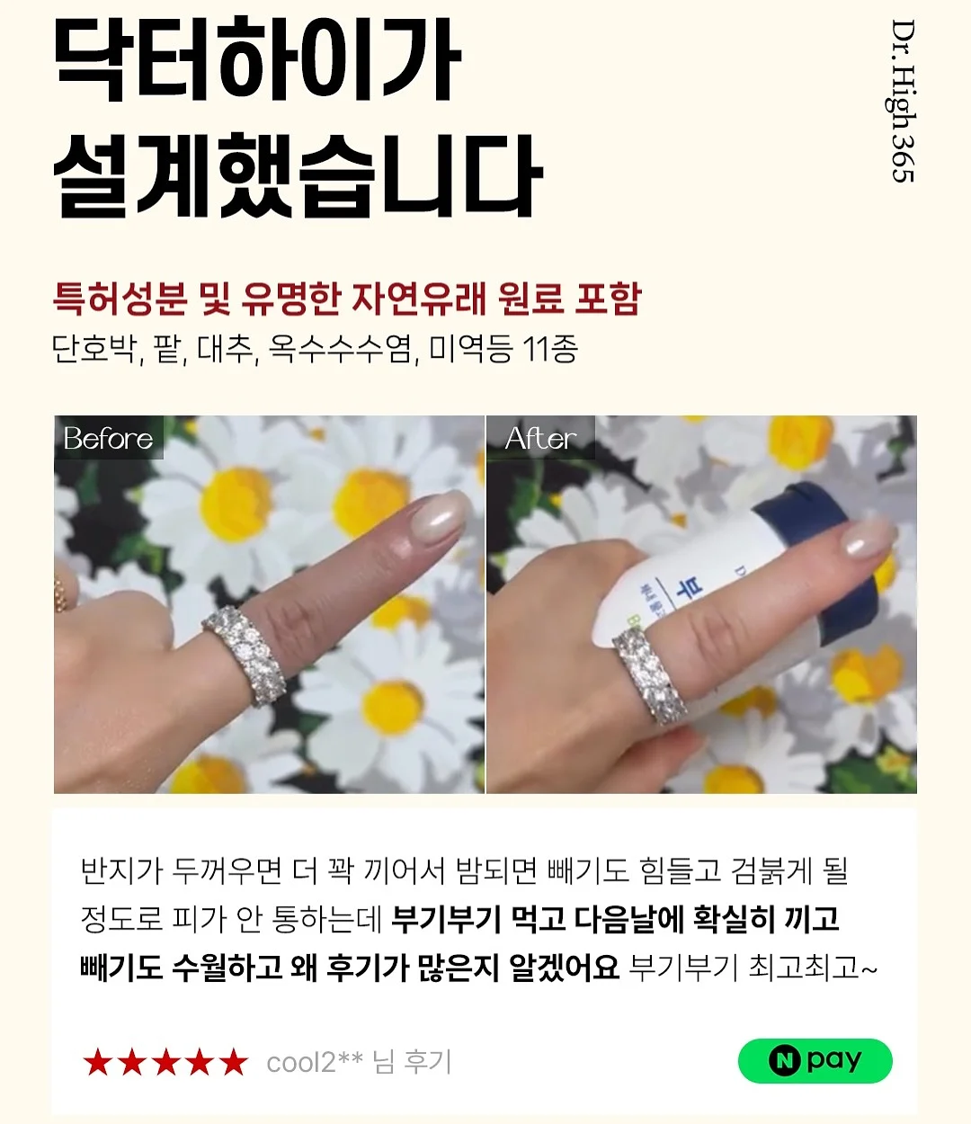 모기퇴치참 10