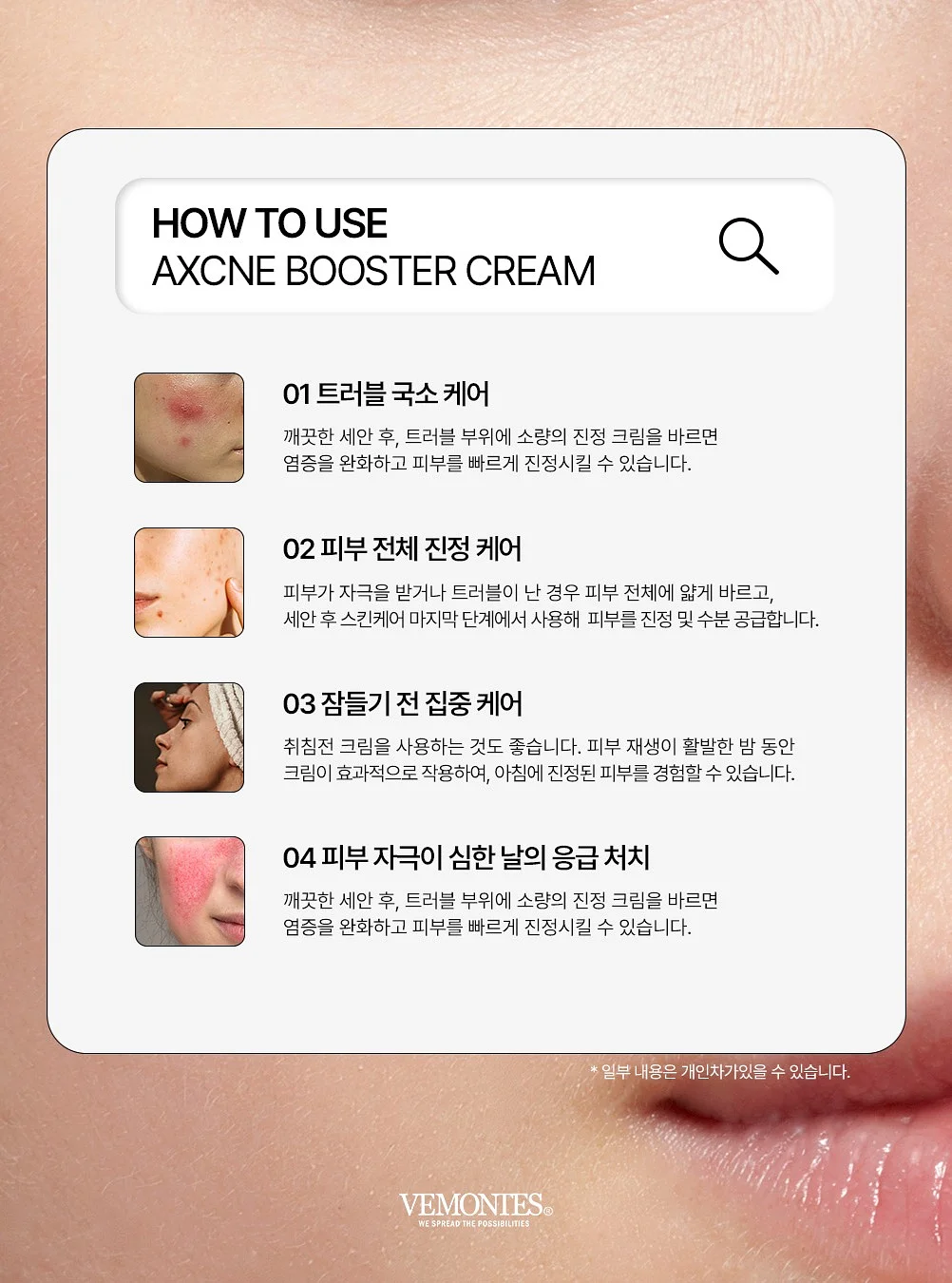 필로티카 엑시올 세럼 & 엑시딘 크림 6