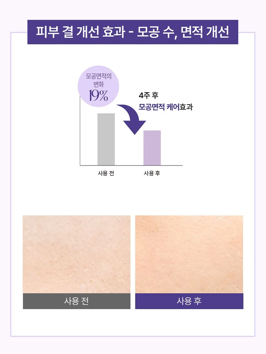 폴로 빅포니 가디건 12