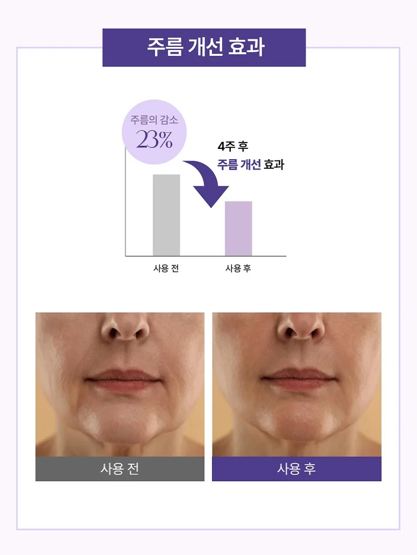 폴로 빅포니 가디건 13