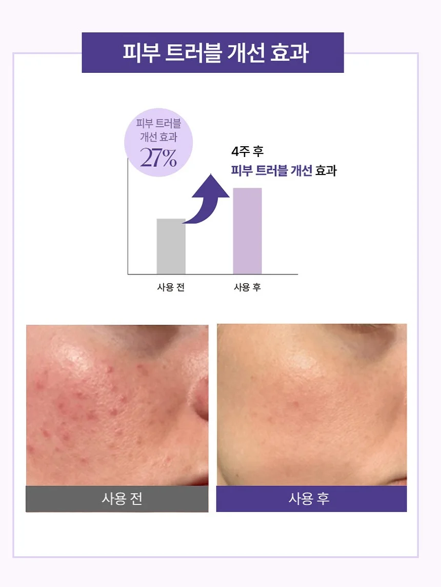 폴로 빅포니 가디건 8