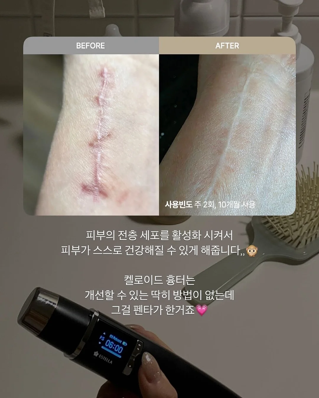 신혼 가구 풀패키지 9