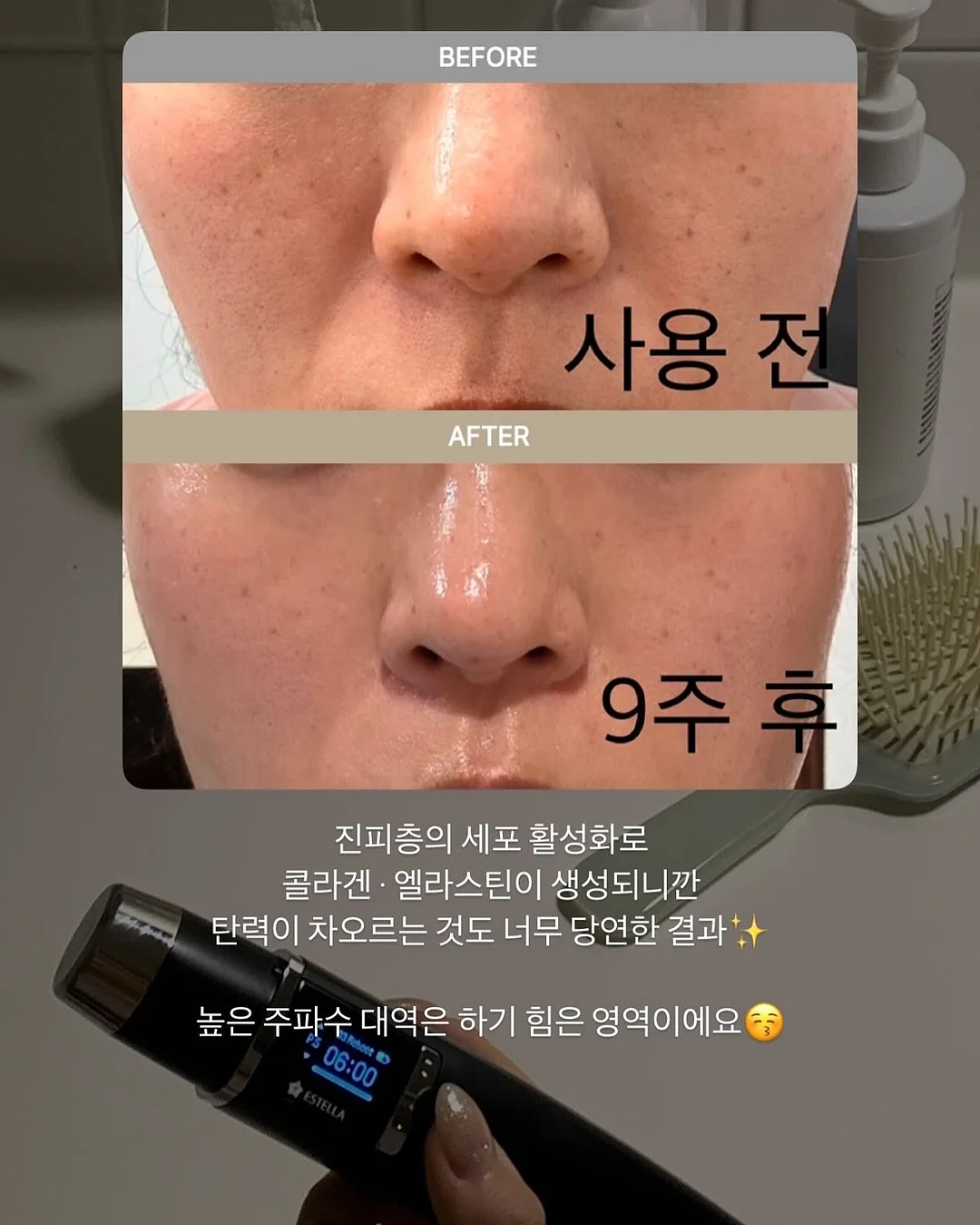 신혼 가구 풀패키지 10