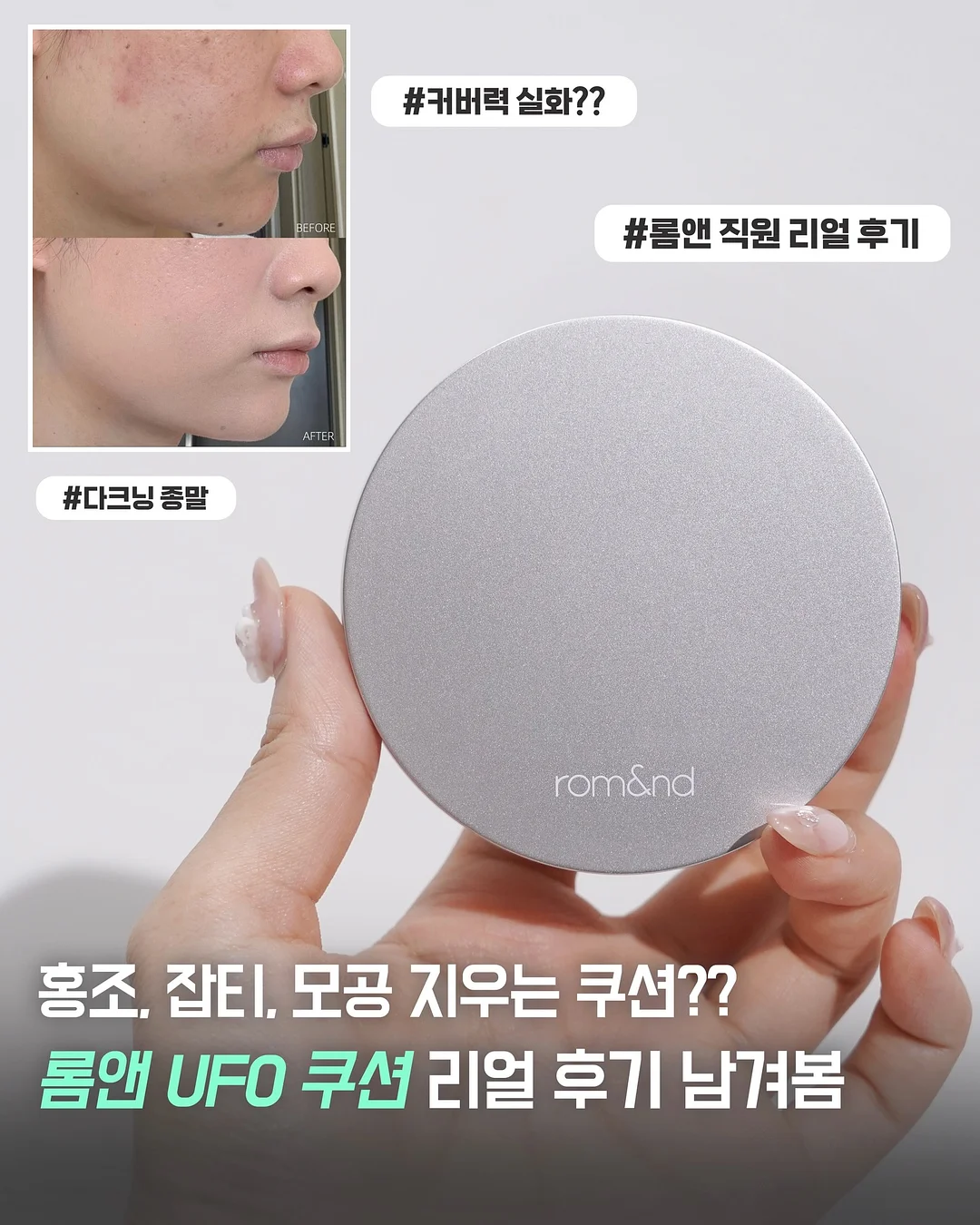 SNP 잡티패드 1