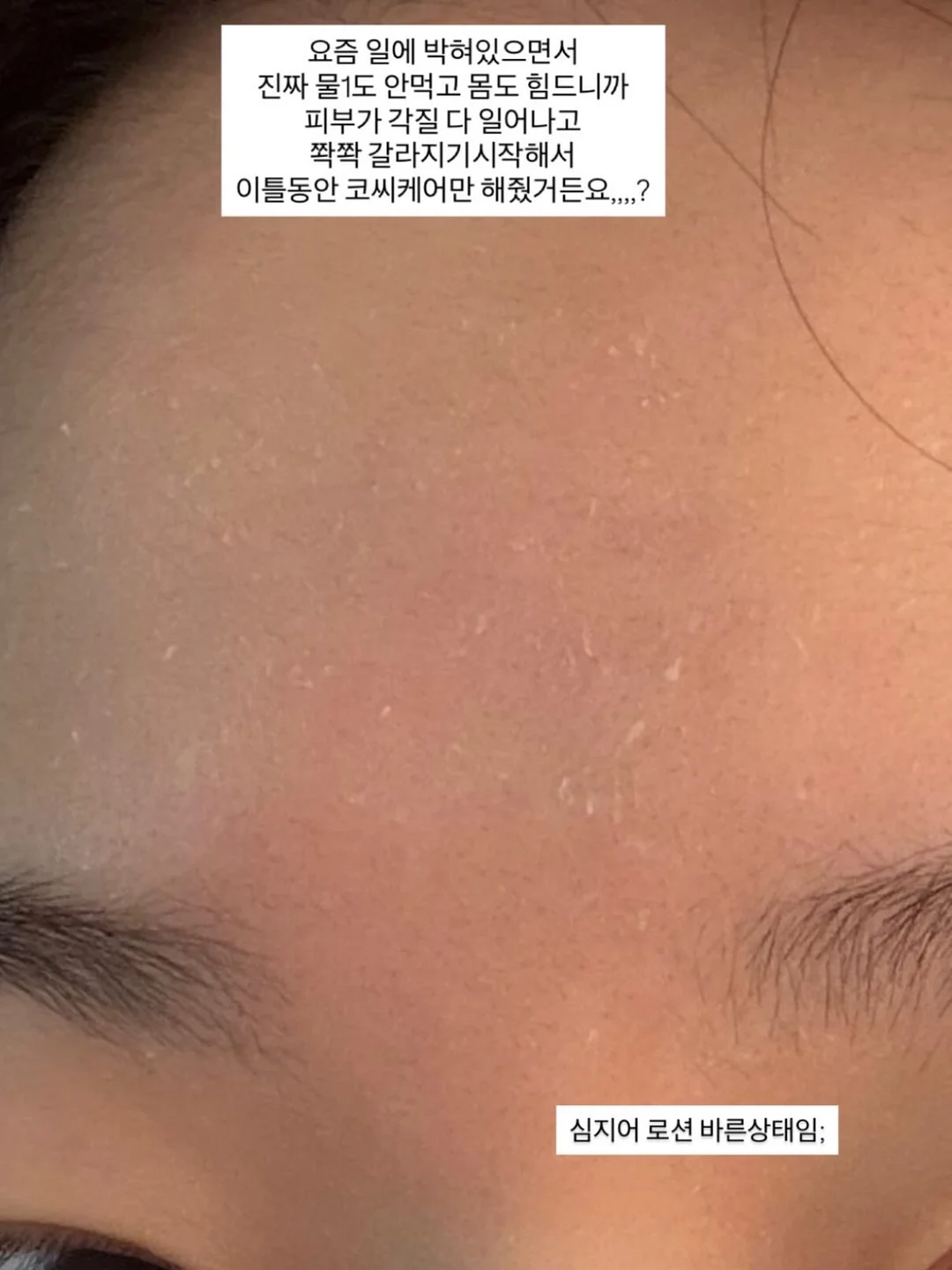 폴로 코맥 플리츠 쇼츠 2