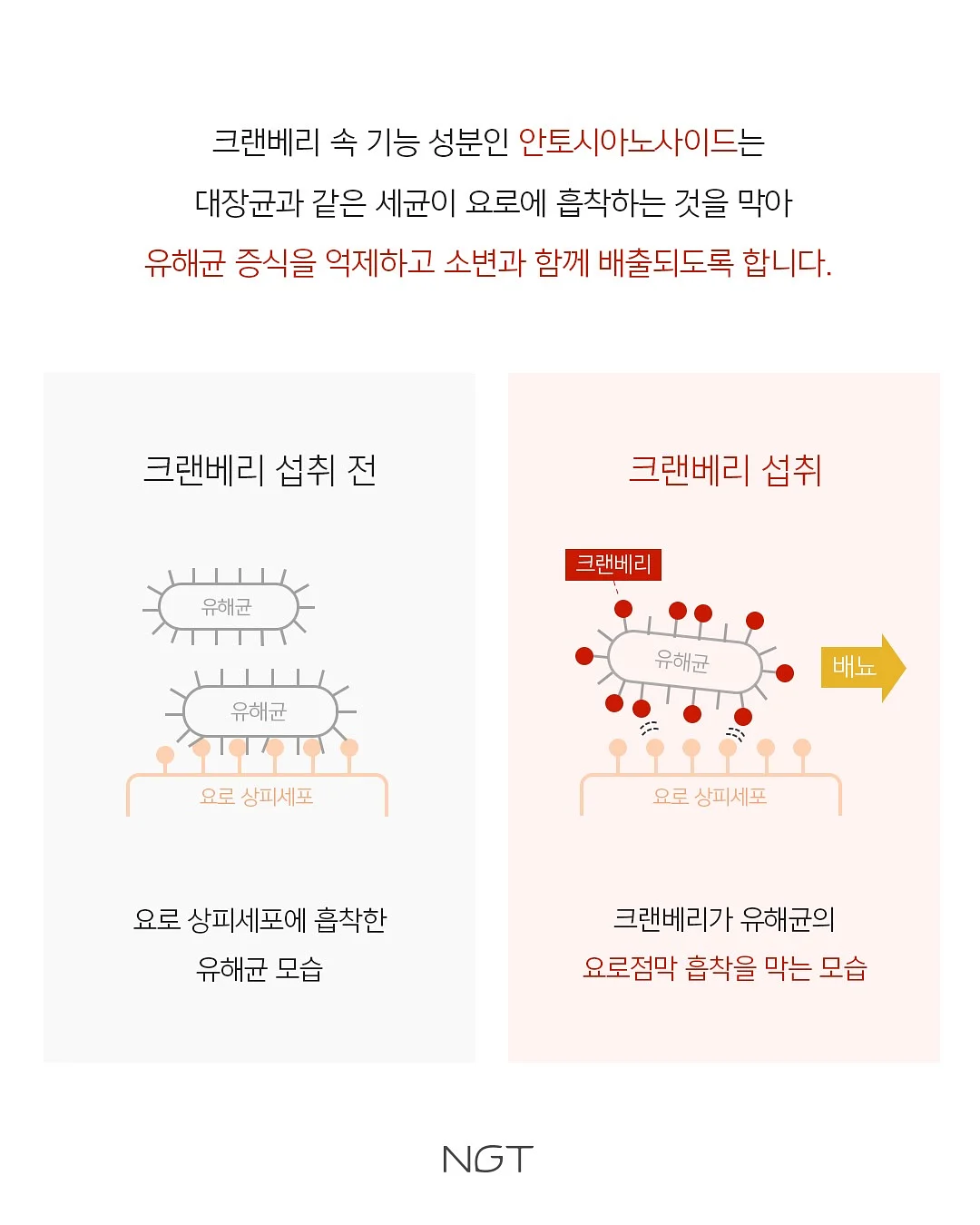 시작버튼 키캡키링 6