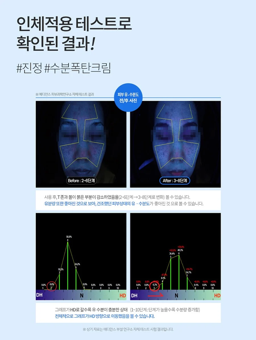 여름 코디 5