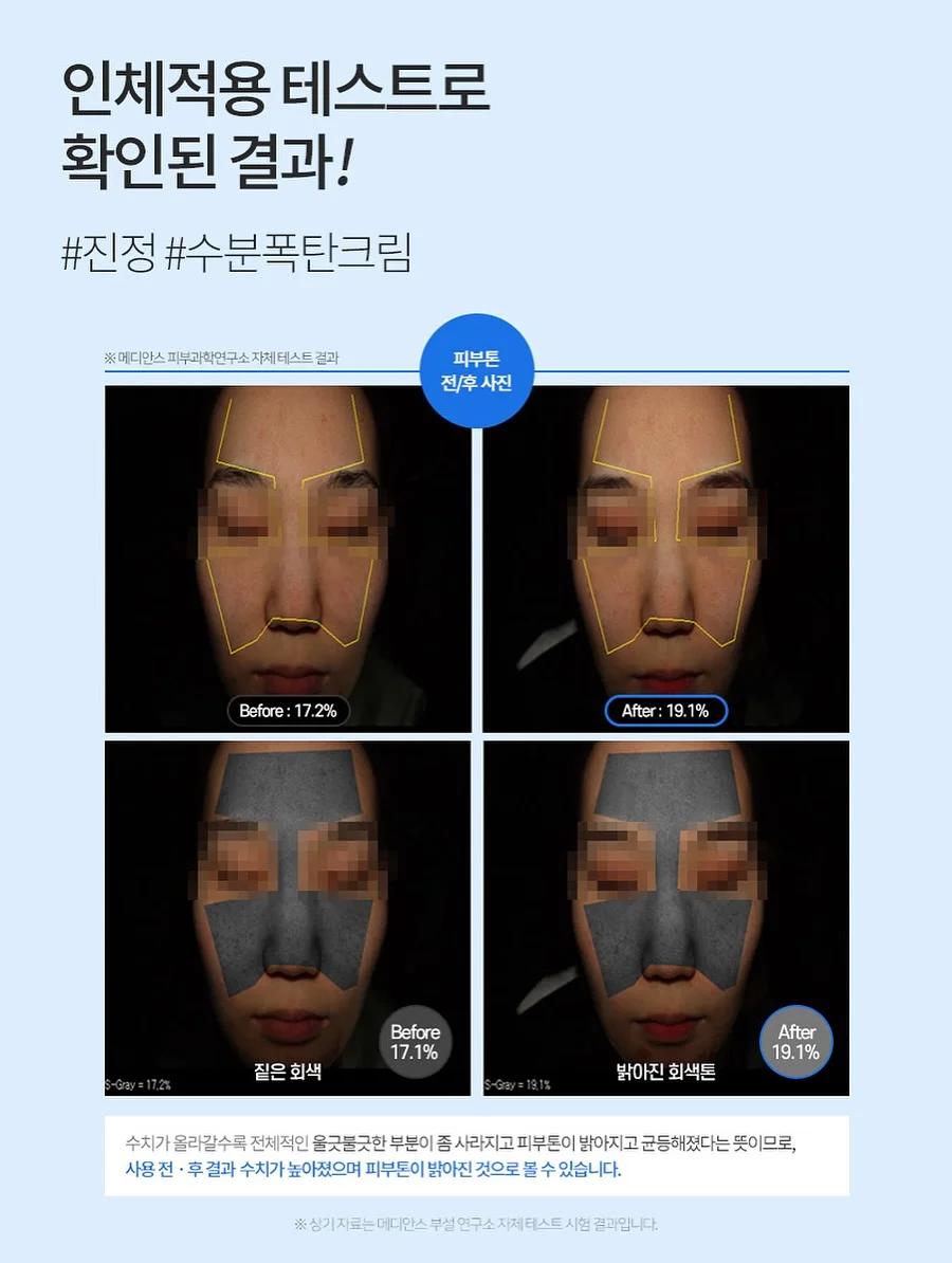 여름 코디 6