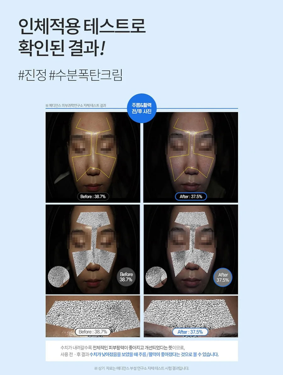 여름 코디 7