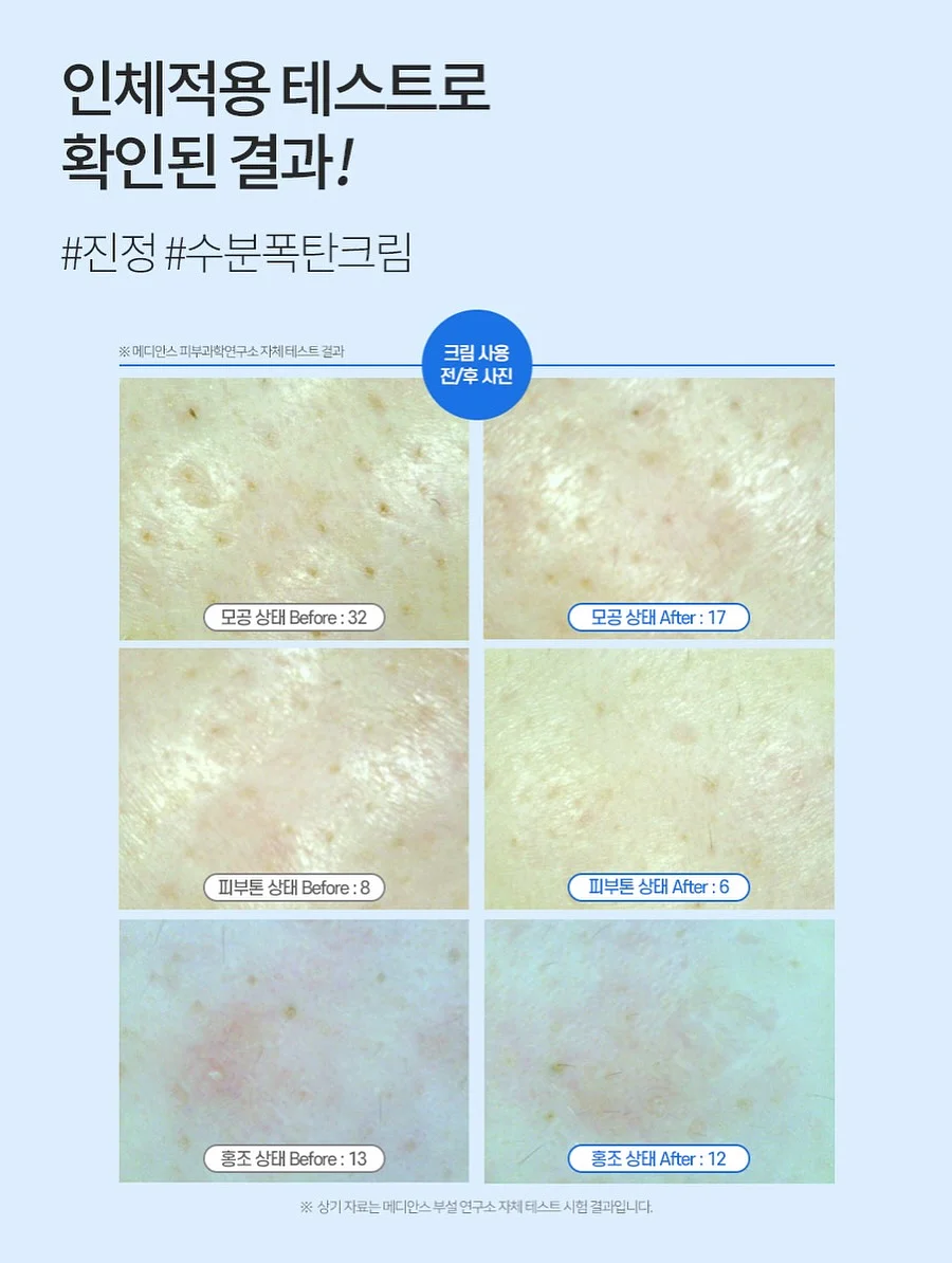 여름 코디 9