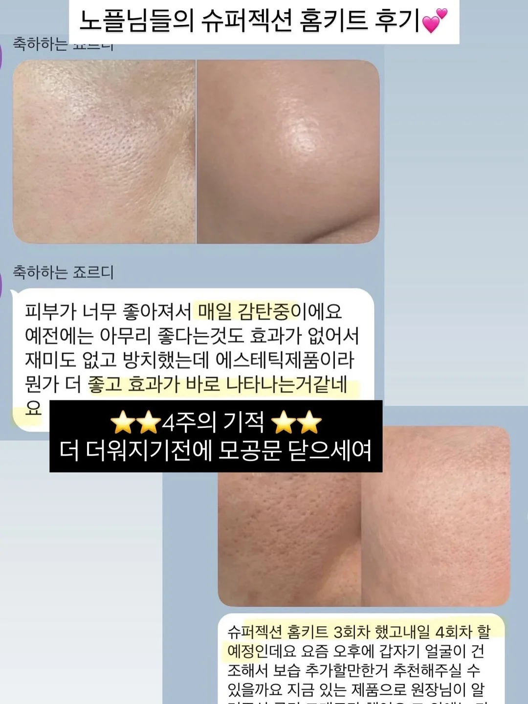 물세럼 7