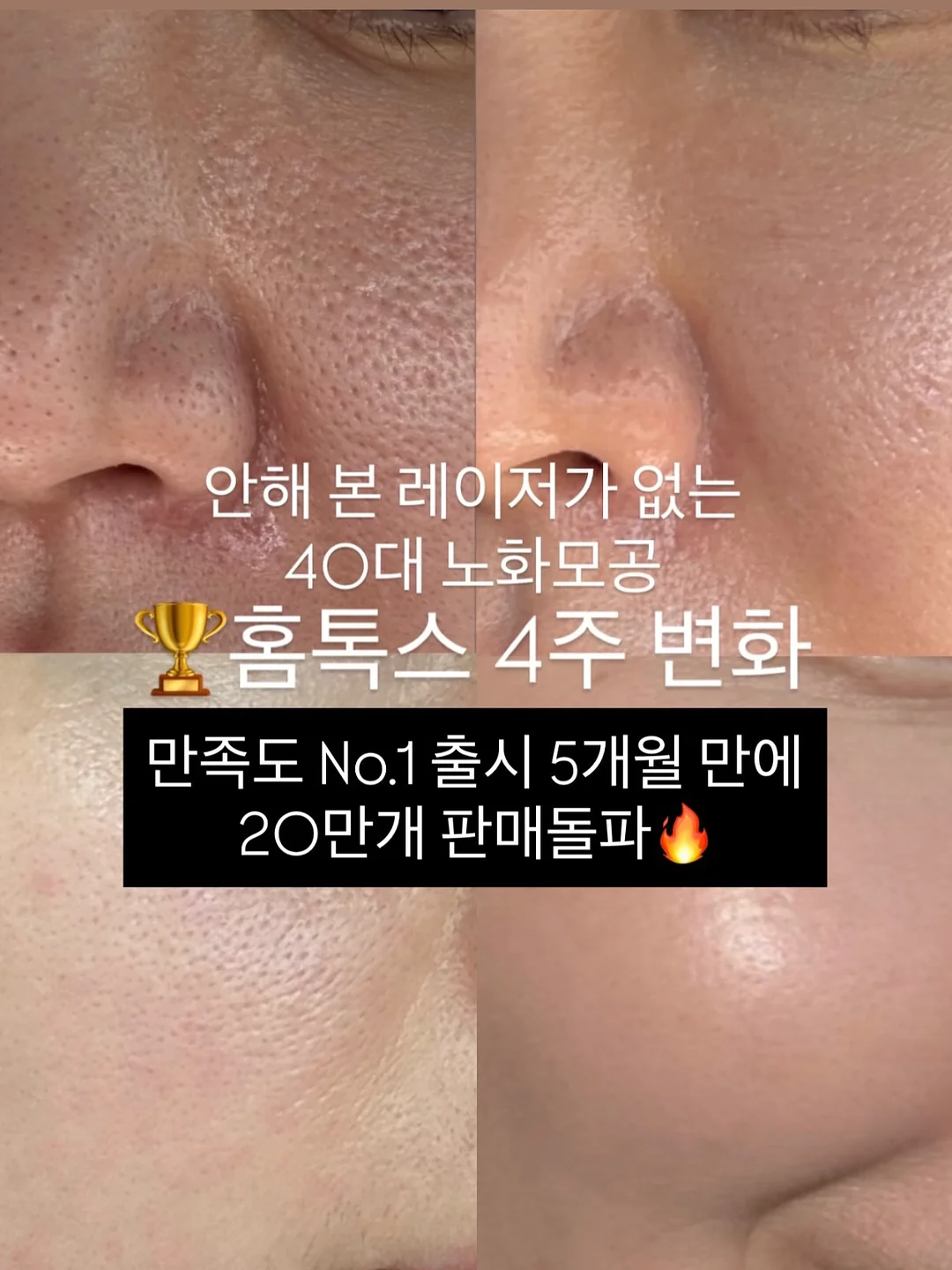 물세럼 8