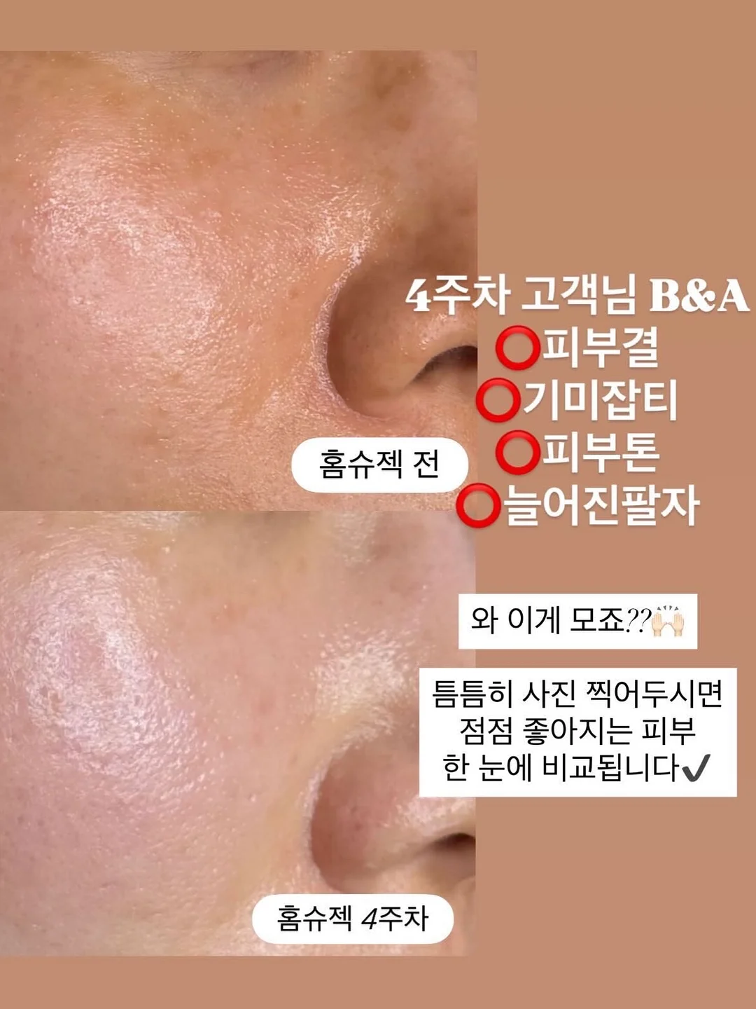 1:1 맞춤케어 2