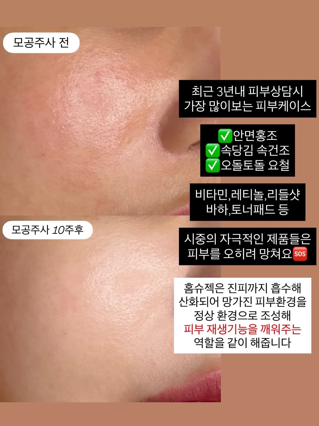 1:1 맞춤케어 4