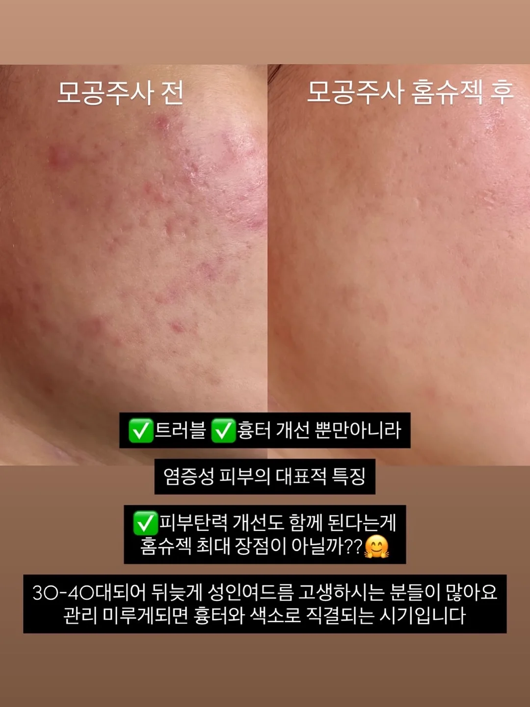 1:1 맞춤케어 5