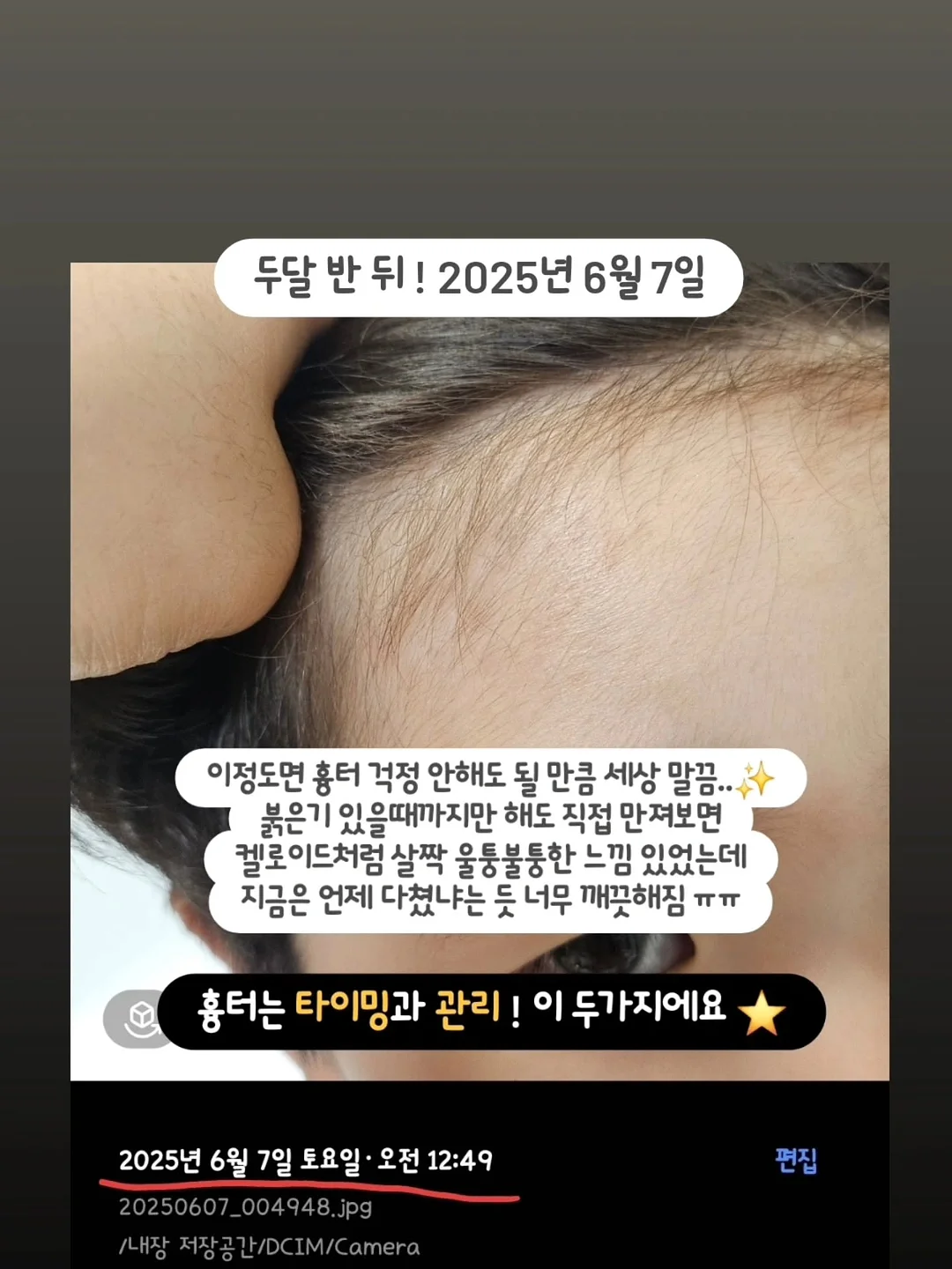 토끼혀 필름 7