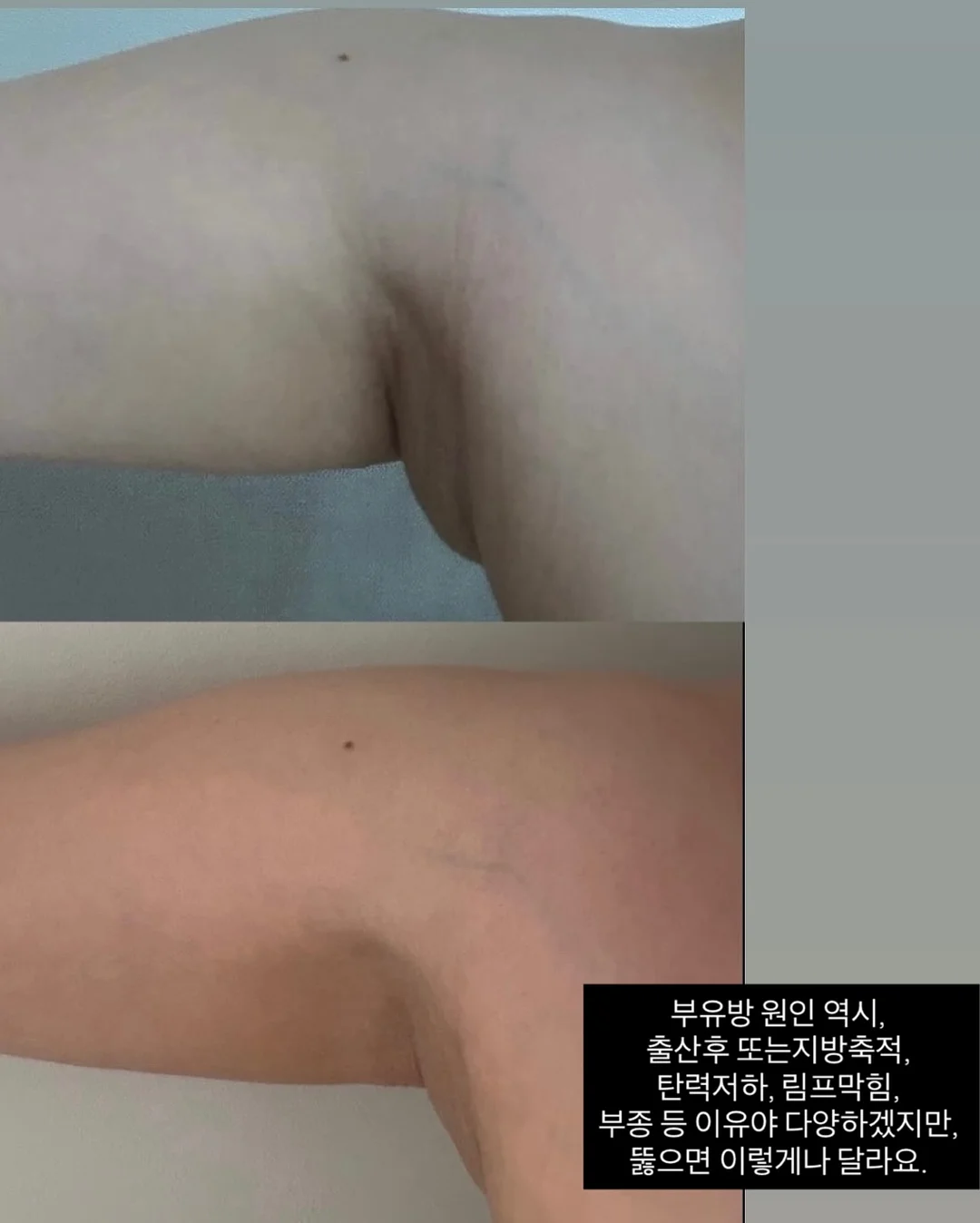 산마늘 버터 3