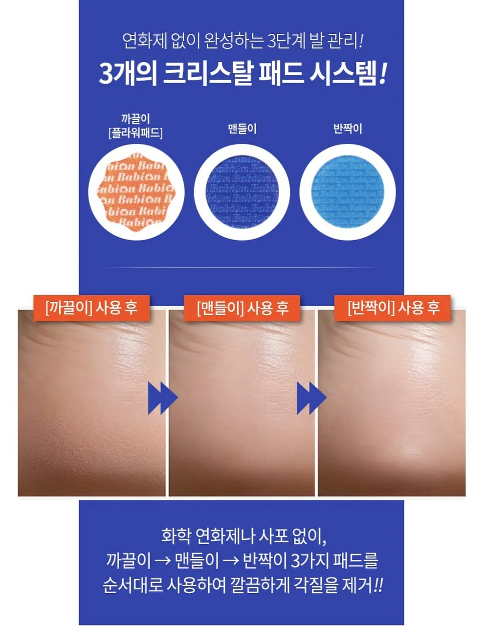 컨버스 하이탑 18