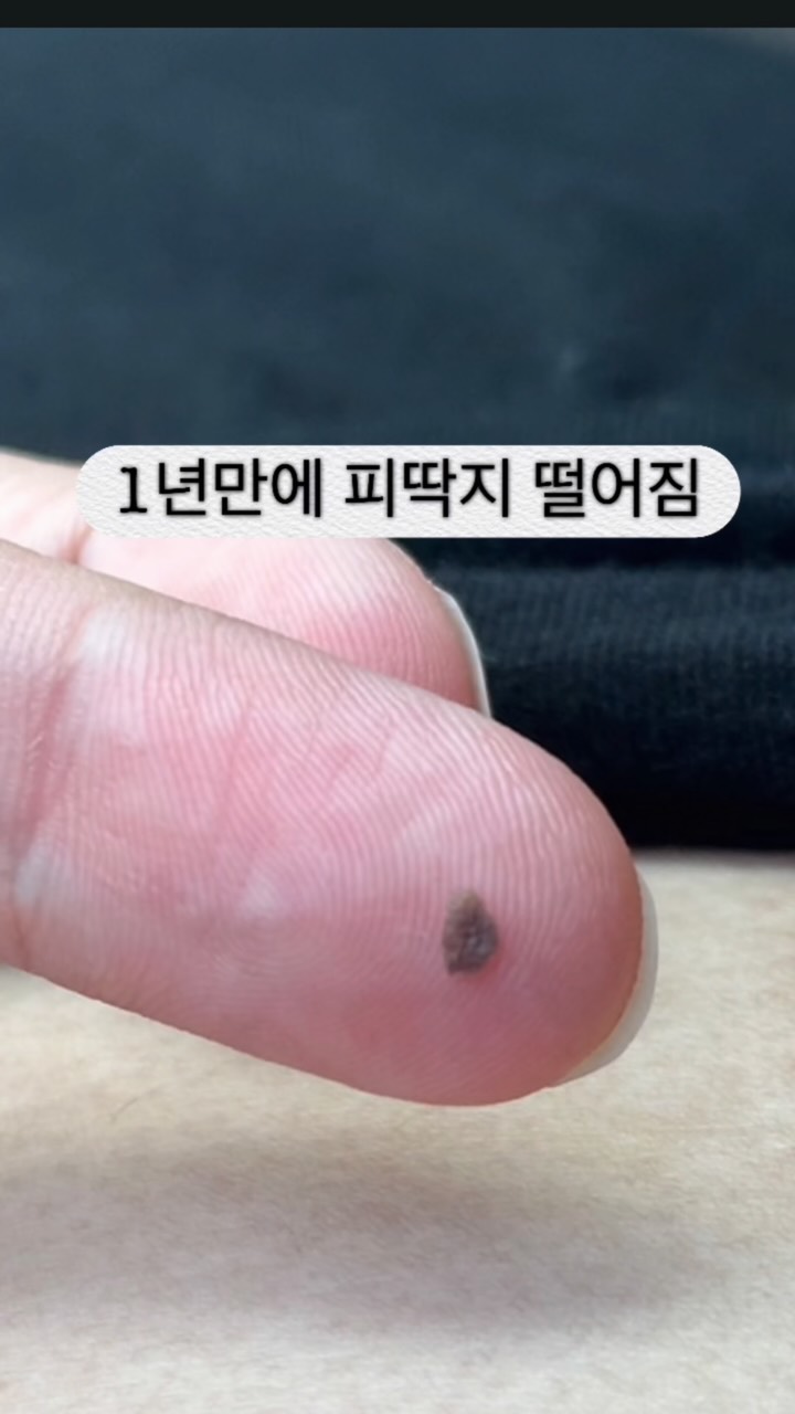 아닐로 샴푸