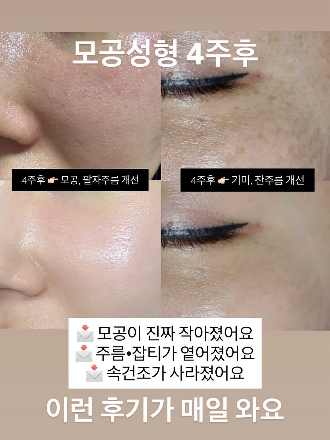 케네스필드 제품 4