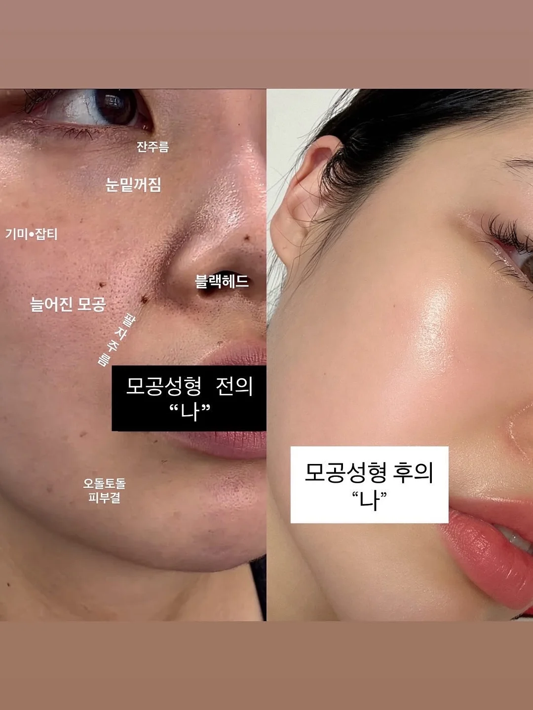 케네스필드 제품 6